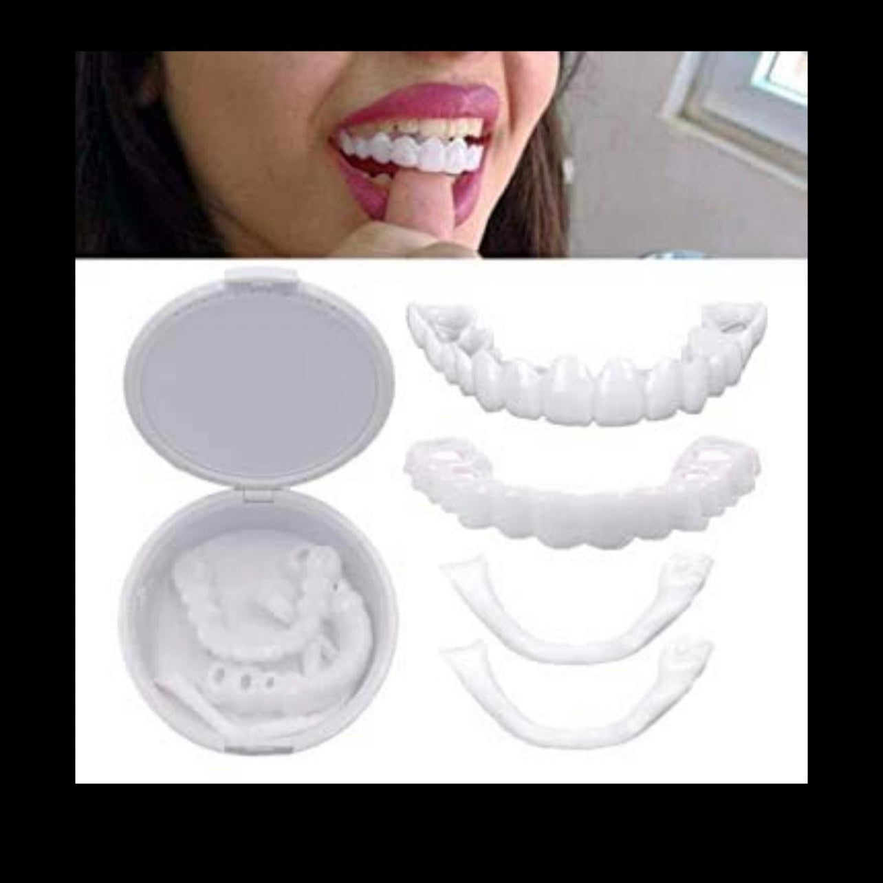 Snap-On Smile Veneers – Instant Hollywood Smile